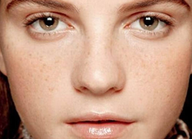 消除色斑是有诀窍的,这5件事,美白淡斑效果好(去斑如何有效果?