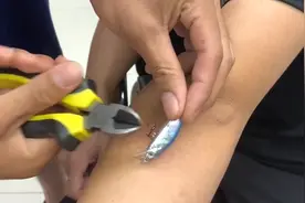 浙江宁波一男子甩鱼杆勾到手臂，求助消防自带讲解：我来过，上回也这样图片