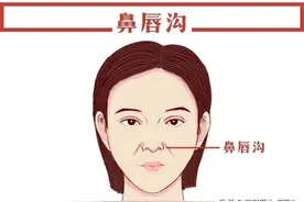 鼻唇沟部网格化分区与脂肪移植图片