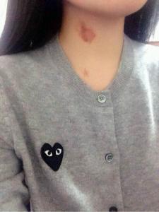 13岁女儿脖子出现"草莓印",妈妈没骂没打,一招挽救女儿恋爱