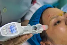 给那些想做"机打水光针"的，一些真实的建议图片