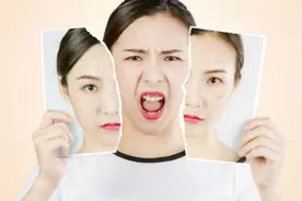 来自“战痘”一族的灵魂拷问：祛痘霜能拯救我的脸吗？图片