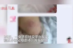 山东一女孩发文称被父母虐待被逼吃药？官方回应：网传情况基本不属实图片