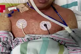 “夺命蚁”入侵12省！有人被咬死，有人双目失明！深圳10个区都有图片