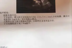 孕早期注意事项及产检报告指标解读图片