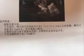 孕早期注意事项及产检报告指标解读图片