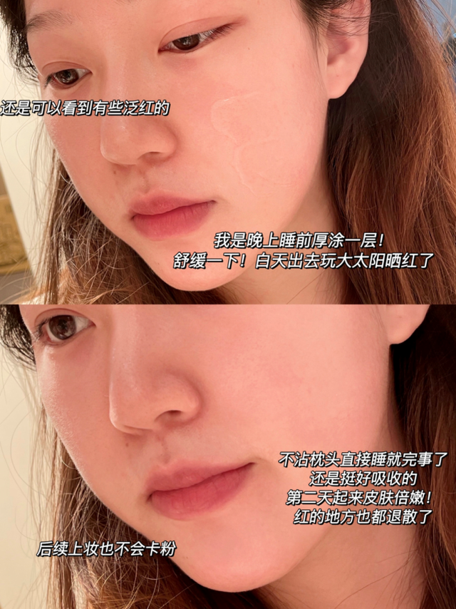 姊妹花芦荟胶 2026年姊妹花芦荟胶的功效