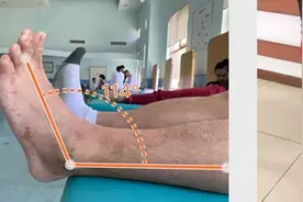 得了骨科病，为什么要康复？图片