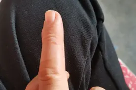 好悬，差点被螃蟹夹断手指！图片