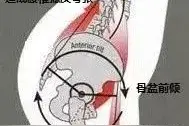 体能康复 | 跳绳中容易出现哪些问题呢？图片