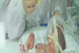 协和母乳库：134位早产婴儿得到捐赠母乳哺育，母乳库让母爱传递图片