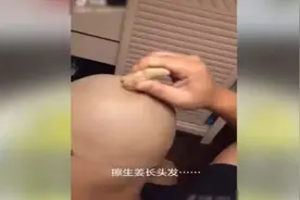 生姜能治疗脱发 是真是假？速看真相…图片