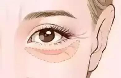 空心斑是汗孔角化症吗