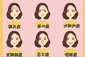 脸上不同部位长痘痘的诱因和改善方法，你知道几个？图片