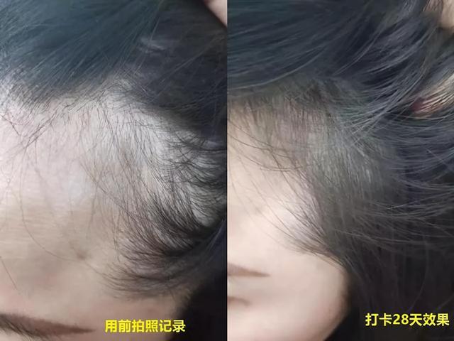 年纪轻轻就有秃顶危机？防脱发洗发水走起，秀发慢慢“柔顺亮滑”