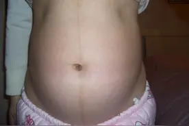 怀孕6个月进行产检，孕妈体重不增反减，医生气不打一处来：无知图片