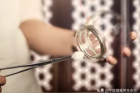 网传，拔罐后罐印颜色越深，寒气越重！让中医专家来告诉你真相图片