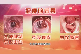 便秘、胀气不要怕！学会一套操，促进肠蠕动，排便顺畅少烦恼图片