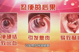 便秘、胀气不要怕！学会一套操，促进肠蠕动，排便顺畅少烦恼图片
