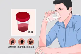 【视频科普】尿血了！别害怕图片