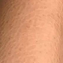 野脚鸡皮肤穿裙子 野脚鸡皮肤穿裙子