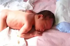 儿子长出“怪毛”，妈妈果断拔出，直接把娃弄进了ICU图片