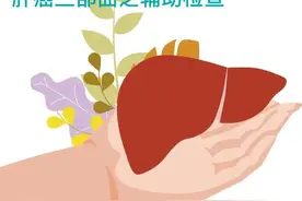 肝癌三部曲之原发性肝癌的辅助检查及治疗原则图片