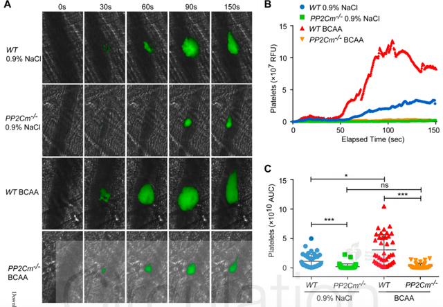 增肌不成反伤身，支链氨基酸补充剂竟然有害