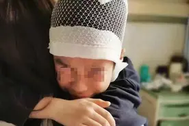 9岁小学生被老师揪头发致皮骨分离，涉事老师被刑拘图片