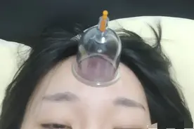 据说在额头拔火罐可以治疗头晕眼花？紫角大王图片