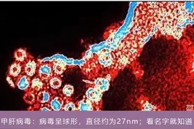 女生内裤上的分泌物是啥？内裤和袜子一起洗，会交叉感染吗？图片