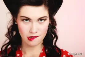 被女朋友咬了需要打狂犬疫苗吗？图片