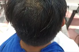 10年前流行的烟花烫，又重新被年轻人喜欢图片