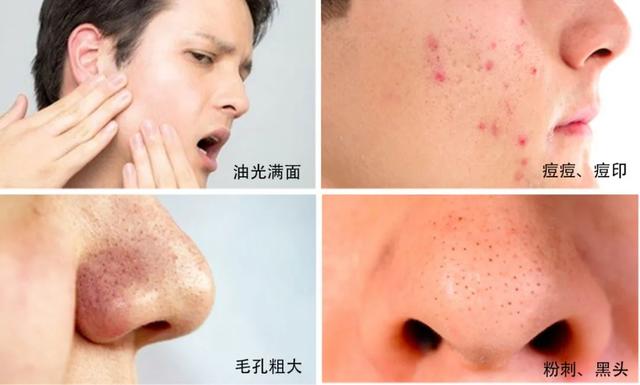 鍥借揣娲侀潰閿€閲廚O.1锛屾瘡20绉掑崠鍑轰竴鐡讹紝鍖呮枃濠х柉鐙傚畨鍒╃殑姘ㄥ熀閰告磥闈? onerror=