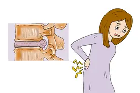 引起腰椎间盘突出的原因是什么？早点预防图片