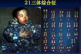 ​孕中期产检：重要项目及检查时间，关乎母子健康，一次都别落下图片