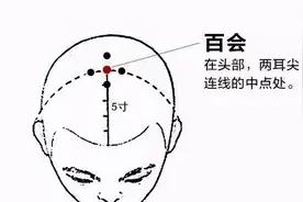 太“秃”然？憋慌！中医教你化解“头顶尴尬”！图片