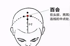 太“秃”然？憋慌！中医教你化解“头顶尴尬”！图片