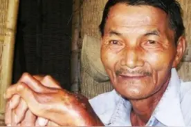 美国小伙挑战“不睡觉”极限，连续264小时不合眼，最后咋样了？图片