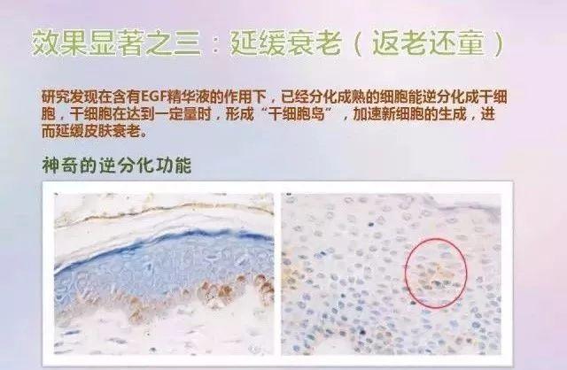 冻干粉是什么，有什么作用?如何正确使用？你想知道的都在这里了