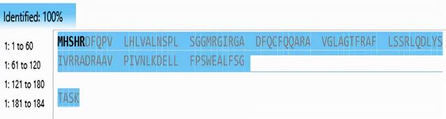 鎶€鏈崌绾т辅楂樺垎杈ㄨ川璋卞姪鍔涘ぇ鍒嗗瓙铔嬬櫧鑽墿缁撴瀯纭瘉鐮旂┒
