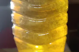 前列腺钙化患者排出的尿液中有絮状物，医生却说这是改善的征兆图片