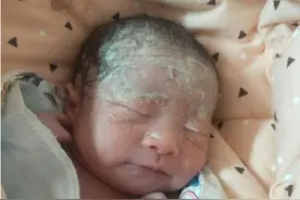 新生儿身上的一层白是什么？虽然看着很“脏”，却不建议家长擦掉图片