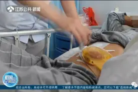 “致命”玩笑！男子被同事用高压枪塞肛门充气致直肠乙状结肠破裂，有人因此丧命图片