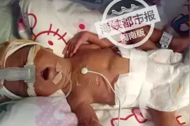心疼！福建抗疫女护士，怀孕不足7月产下双胞胎，仅2斤重！救救他们！图片