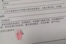 孩子手背割伤，家长坚持不缝合，背后是对医方彻底的不信任感图片