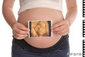 【科普知识】胎儿四维彩超检查很重要，这些事项你需要了解图片