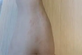 长成一条线的就是线状苔癣？图片