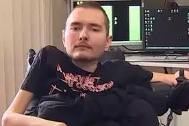 “换头术”实现2次成功连接，意味着什么，人类真的可以永生？图片