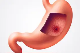 「问诊台」“胃痛”并不都是胃病图片